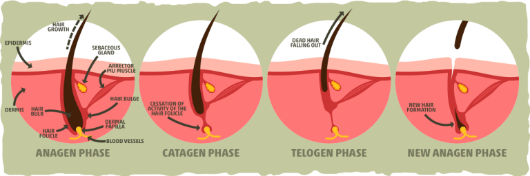 Keto Hair Loss: 5 Common Causes & Tips to Prevent Hair Loss